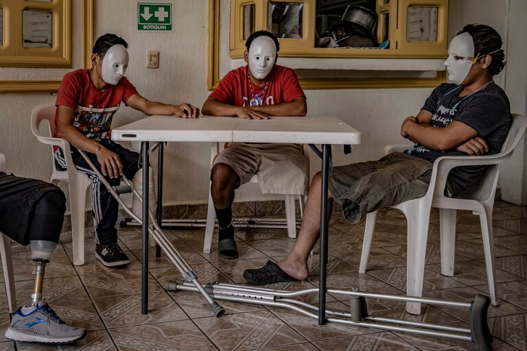 Los amputados de la Bestia